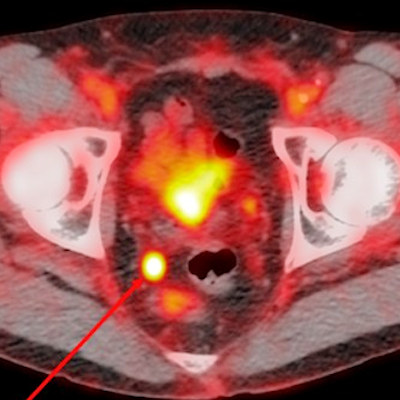 2021 05 27 15 28 4419 2021 05 27 Pylarify Image Aunt Minnie pptx 400