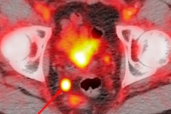 2021 05 27 15 28 4419 2021 05 27 Pylarify Image Aunt Minnie pptx 400