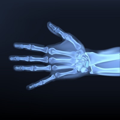 2017 11 15 23 12 3096 Hand X Ray 400