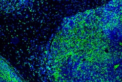 2021 01 12 22 13 6193 Immunotherapy T Cell Fluorescence 400