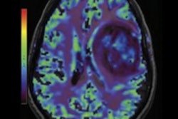 2021 06 02 18 17 1094 2021 06 03 Fmri Brain Tumor Clinical Image 400
