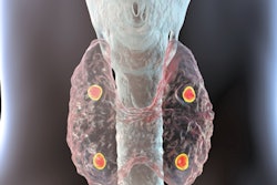 2021 06 02 22 17 8771 Parathyroid Glands 400