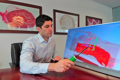 HoloMedX offers a glasses-free holographic surgical simulation platform. Image courtesy of Xenco Medical.