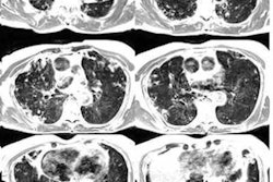 2021 06 10 19 04 1001 2021 06 11 Mri Lung Imaging Figure1 20210610194631