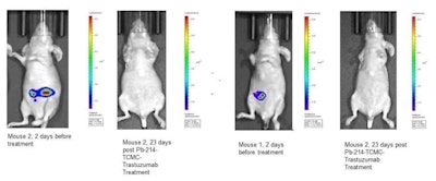 Bioluminescence images overlayed with pictures of mice implanted intraperitoneally with luciferase-positive ovarian cancer cells (SKOV3) before and after treatment with Pb-214-TCMC-trastuzumab. Image courtesy of SNMMI.