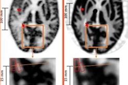 2021 06 14 20 38 3245 2021 06 14 Super Resolution Brain Image 20210614204456