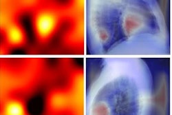 2021 06 18 22 19 2704 2021 06 22 Heat Map Chest X Ray Ai Read 20210618224144