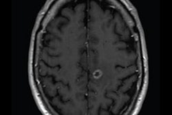 2021 06 18 23 46 7709 2021 06 17 Reduced Dose Brain Mri 400