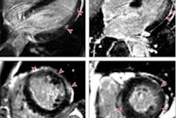 2021 06 29 00 53 0308 2021 06 29 Myocarditis 20210629000918