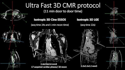 The new ESSOS cardiac MRI protocol can acquire faster 3D images. Image courtesy of Philips.