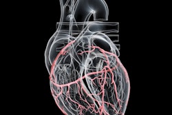 2020 08 26 18 55 9693 Artery Heart 3 D 400