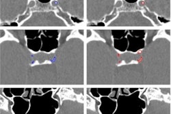 2021 06 30 22 12 6714 2021 07 01 Radiology Ai Bortsova Figure5 20210630220913