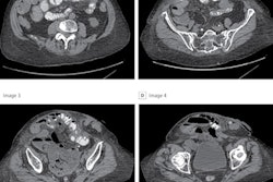 2021 07 06 22 37 3033 2021 07 07 Jama Surg Image 400