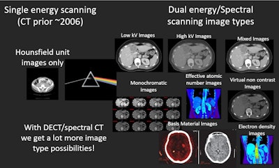 Many more image types are available with dual-energy than with single-energy CT, including images reconstructed at particular energy levels (monochromatic, aka monoenergetic), images that represent a mixture of low and high energy levels, and virtual noncontrast images. Image courtesy of Timothy Szczykutowicz, PhD.
