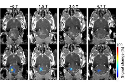 In a mouse model study of MRI-guided focused ultrasound-induced blood-brain barrier (BBB) opening at MRI field strengths ranging from approximately 0 tesla (outside the magnetic field) to 4.7 tesla, the static magnetic field dampened the detected microbubble cavitation signal and decreased the BBB opening volume. Image courtesy of Washington University in St. Louis.