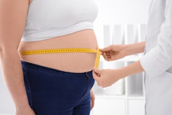 2021 07 12 22 43 1682 Obesity Woman 400