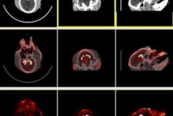 2021 07 14 20 44 8178 2021 07 15 Micro Pet Monkey Brain Image 20210714203821