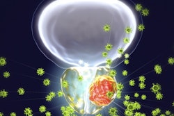 2021 07 14 22 37 8043 3 D Prostate Cancer Viral 400