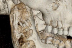 2021 07 15 17 21 6165 2021 07 21 Bonitz Ct Jaw 400