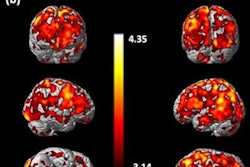 2021 07 22 18 26 7613 2021 07 26 C 11 Bu99008 Brains 20210722182654