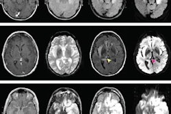 2021 07 26 23 45 8784 2021 07 27 Jama Network Open Mri Enceph 20210726233558
