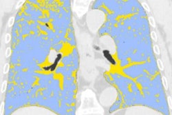 2021 07 27 22 34 3901 2021 07 28 Radiology Caruso Figure4 Social 20210727220755