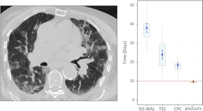 Predicted overall survival time (mortality) of a 67-year-old male who expired 10 days (red dotted line on the plot on the right) after the chest CT examination. The image on the left shows a representative example of the CT images. The plot on the right shows the predicted survival times (circles) by pix2surv and the image-based reference predictors (percentage of well-aerated lung parenchyma, total severity score, crazy paving and consolidation on CT, and lab tests) and with 95% confidence interval bars superimposed on the boxplots that represent the bootstrap results. Shared via Creative Commons license.