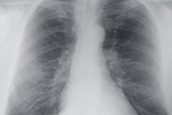 2021 08 05 15 40 4673 2021 08 06 Cxr 5 Point Score 20210805153159