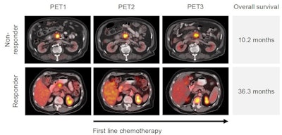 Image courtesy of the Journal of Nuclear Medicine.