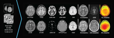 SpinTech's STAGE software is designed for postprocessing of brain images. Image courtesy of SpinTech.