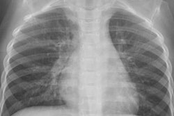 2021 08 10 18 56 4202 2021 08 11 App X Ray 20210810184938