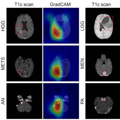 2021 08 10 21 28 8492 2021 08 11 Rsna Mri Deep Learning 20210810215310