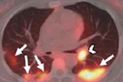 2021 08 10 23 24 4063 2021 08 11 Fdg Cancer Covid 19 20210810231936