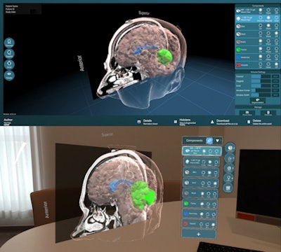 MR-based virtual fitting solution using 3D avatar makes debut