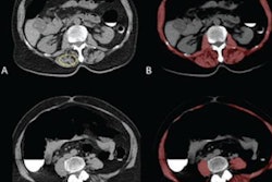 2021 08 19 18 16 0066 2021 08 19 Ai Sarcopenia 20210819184816