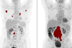 2021 08 19 21 20 4020 2021 08 20 Radiomics Cancer Image 20210819210552