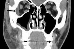 2021 08 23 19 09 1594 2021 08 24 Abscess2 400