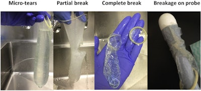 Breakage rates of probe covers and condoms have been analyzed in studies. Above, examples of breakages after ultrasound examinations. Image courtesy of Jocelyne Basseal and Infection, Disease & Health (Infect Dis Health, December 19, 2019, Vol. 19, pp. 30102-30106).