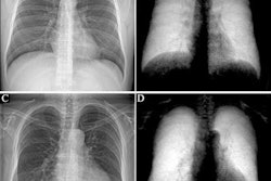 2021 08 26 00 16 0701 2021 08 26 Dark Field X Ray 20210826000718