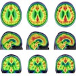 2021 08 30 19 03 2656 2021 08 31 Pet Alzheimer Brains 400