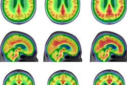 2021 08 30 19 03 2656 2021 08 31 Pet Alzheimer Brains 400