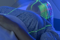 2019 11 09 00 17 8713 Radiation Therapy Planning 400