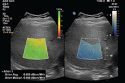 2021 08 31 22 07 9879 2021 09 23 Philips Lfq Image1 400