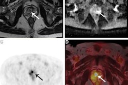 2021 09 02 20 12 3114 2021 09 06 Pet Mri Prostate Cancer 20210902200435