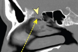 2021 09 09 16 16 3605 2021 09 09 Nejm Knizek Swab Injury 400