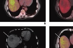 2021 09 09 22 00 1948 2021 09 10 Fdg Liver Cancer 20210909225455