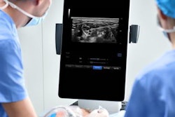 2021 09 10 18 56 3723 2021 09 10 Mindray Te9 20210910185336