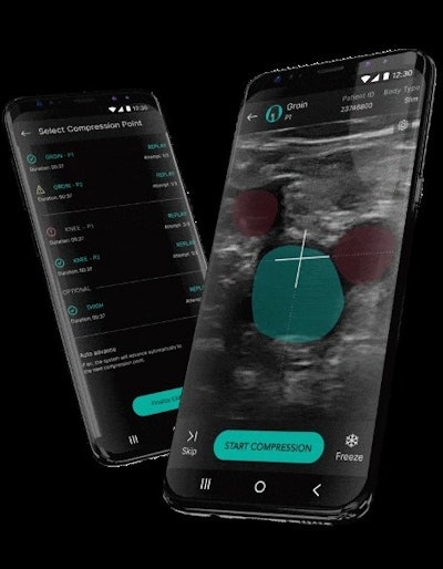 ThinkSono AutoDVT App on a smartphone. Image courtesy of ThinkSono.