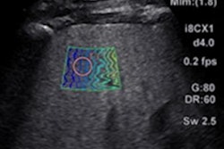 2021 09 17 23 12 2188 2021 09 23 Shear Wave Liver Image1 20210917233247