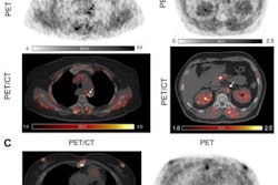 2021 09 20 23 30 1550 2021 09 21 Pet Atherosclerosis 20210920232805